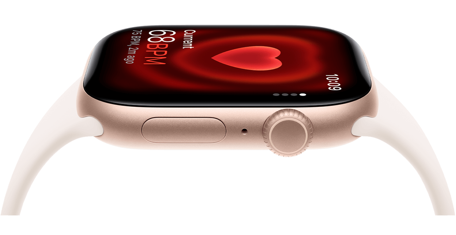 An Apple Watch from a front view