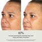 Therabody TheraFace Mask Glo  Clinically Proven LED Skincare Mask, , large