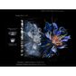 TCL 98" Class X11 Premium 4K UHD HDR QD-Mini LED with Google TV in Black - Smart TV, , large