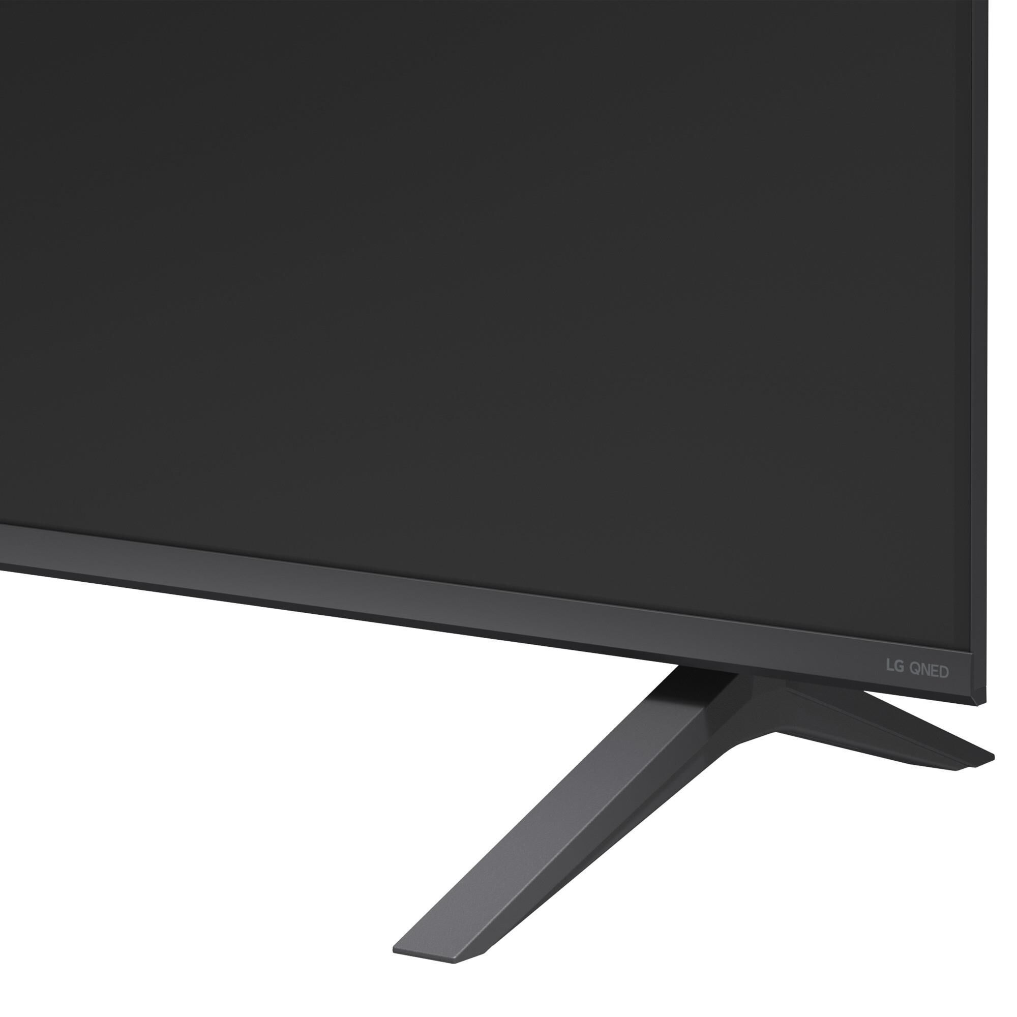 LG 75