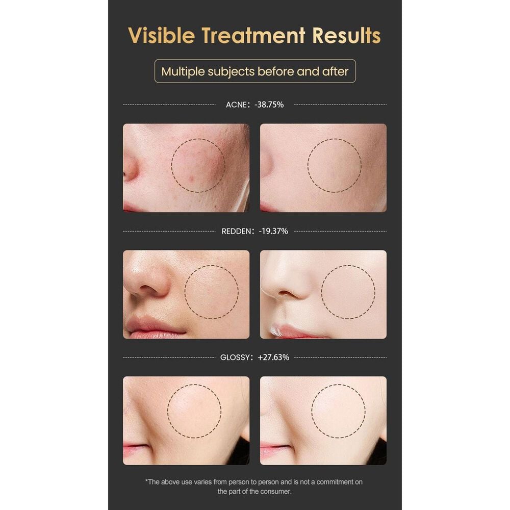 EZlife Red Light Therapy Mask with Vibration in Black, , large